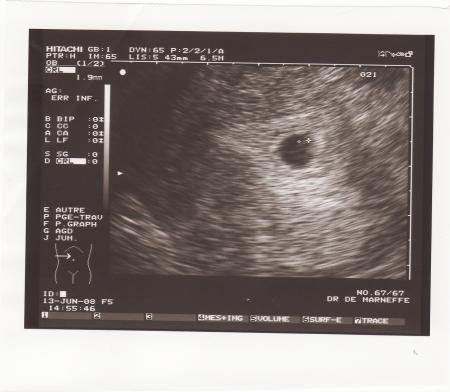 1er echo